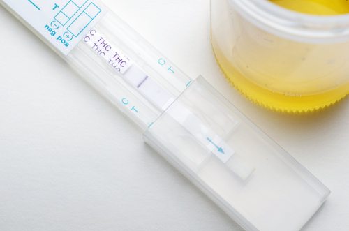 Urine-Drug-Test